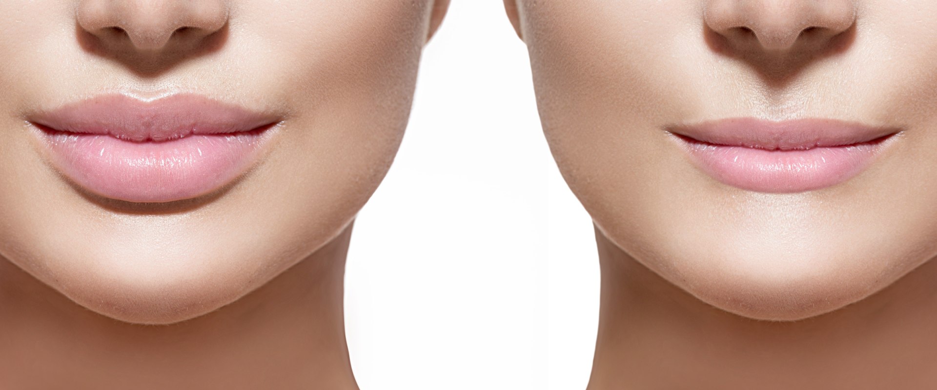 Cuál es el relleno de labios más duradero?