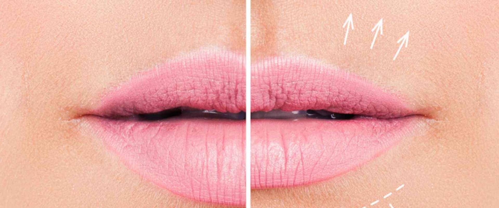 Qué hacer para que crezcan los labios mayores?