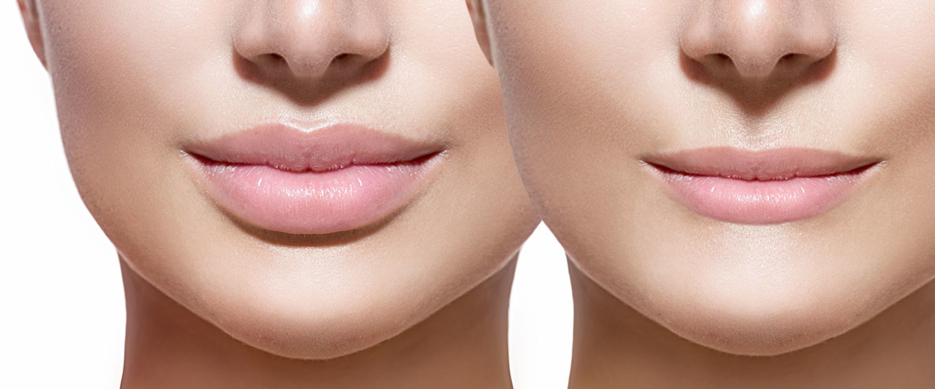 Qué precio tiene el aumento de labios?