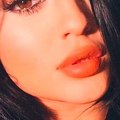 Lo que se debe y no se debe hacer al besarse después de un aumento de labios