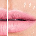 Cómo engordar los labios mayores de forma natural?