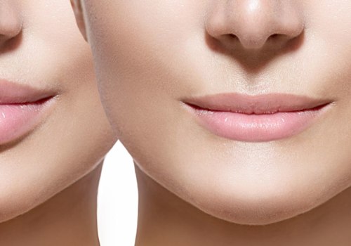 Cómo aumentar el crecimiento de los labios?