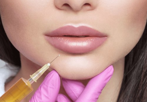 La longevidad de las inyecciones de ácido hialurónico de Juvederm