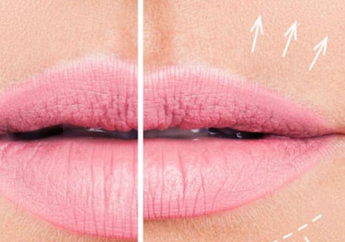 Cómo engordar los labios mayores de forma natural?
